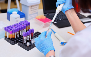 可溶性生長(zhǎng)刺激表達(dá)基因2蛋白（ST2）- 磁微?；瘜W(xué)發(fā)光法（吖啶酯）/熒光免疫層析解決方案