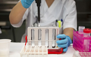 糖鏈抗原19-9(CA19-9)-磁微?；瘜W(xué)發(fā)光（吖啶酯）解決方案