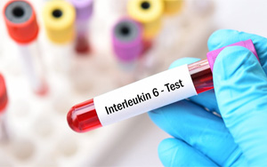 白介素-6（IL-6）-磁微?；瘜W發(fā)光（吖啶酯） /熒光免疫層析解決方案