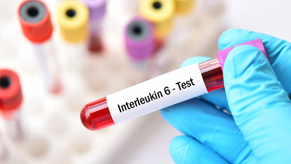 IL-6磁微?；瘜W(xué)發(fā)光熒光免疫層析