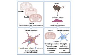 降低一種大腦膽固醇可以減少阿爾茨海默病樣損傷