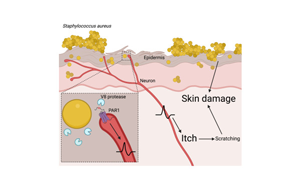 Cell：首次證明一種常見的皮膚細菌可以通過直接作用于神經(jīng)細胞而引起瘙癢