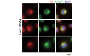 Nature子刊：開創(chuàng)性的將化學(xué)探針引入活細(xì)胞，靶向紅斑狼瘡