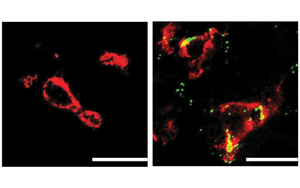 Nature子刊：肝臟中的免疫細(xì)胞會(huì)對(duì)高膽固醇水平做出反應(yīng)，并吃掉多余的膽固醇