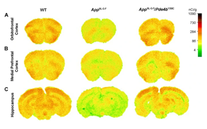 發(fā)現(xiàn)阿爾茨海默病的新治療靶點(diǎn)PDE4B 活性降低27%可大大挽救AD小鼠記憶、大腦功能和炎癥