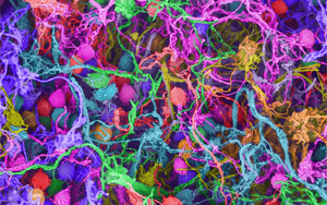 Nature：要想形成長(zhǎng)期記憶，必須有DNA損傷和腦部炎癥？！