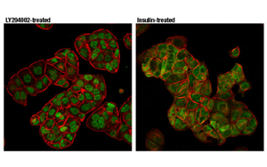 Nature最新發(fā)現(xiàn)控制CAR-T細(xì)胞壽命的蛋白質(zhì)！