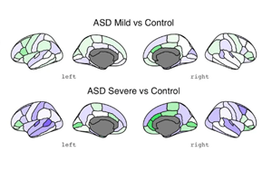 自閉癥最早的生物學跡象